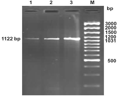 Ovine CD14- an Immune Response Gene Has a Role Against Gastrointestinal Nematode Haemonchus <mark class="highlighted">contortus</mark>—A Novel Report